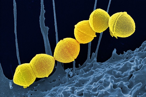 An image of the Strep A bacteria under a microscope
